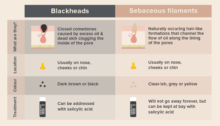 Image showing sebaceous filaments and blackheads